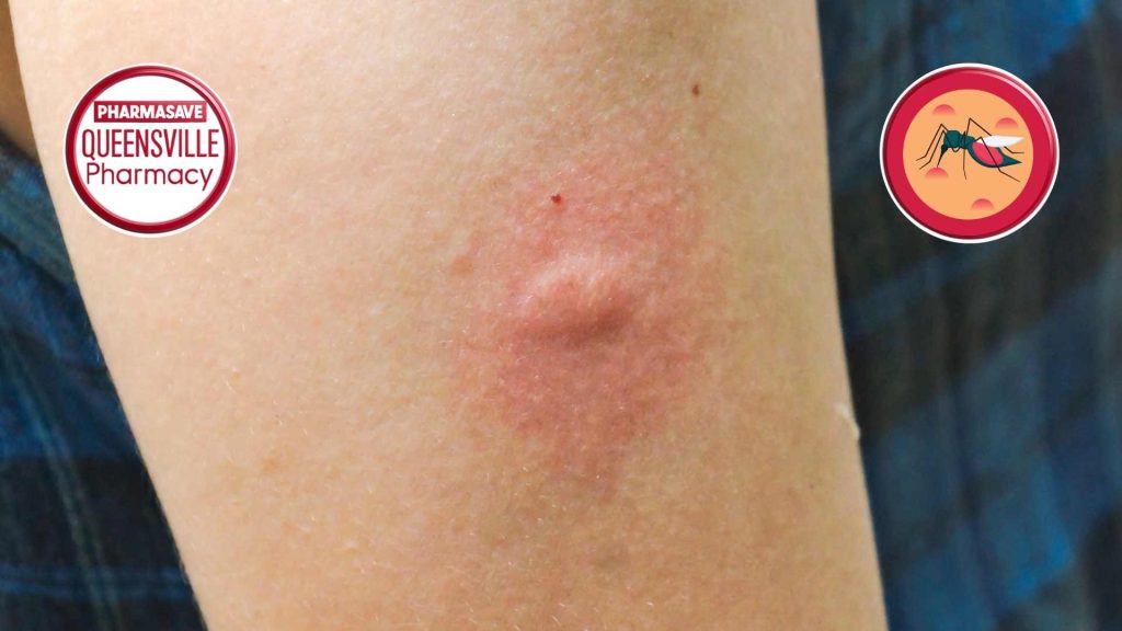 Image of forearm showing reaction to insect bite.