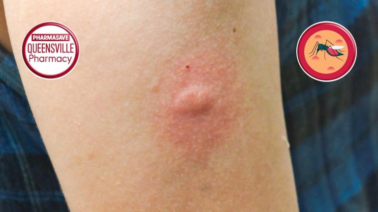 Image of forearm showing reaction to insect bite.