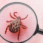 Magnified image of a tick on skin.